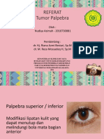 Referat Tumor Palpebra