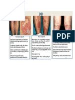 Oncak DD Psoriasis