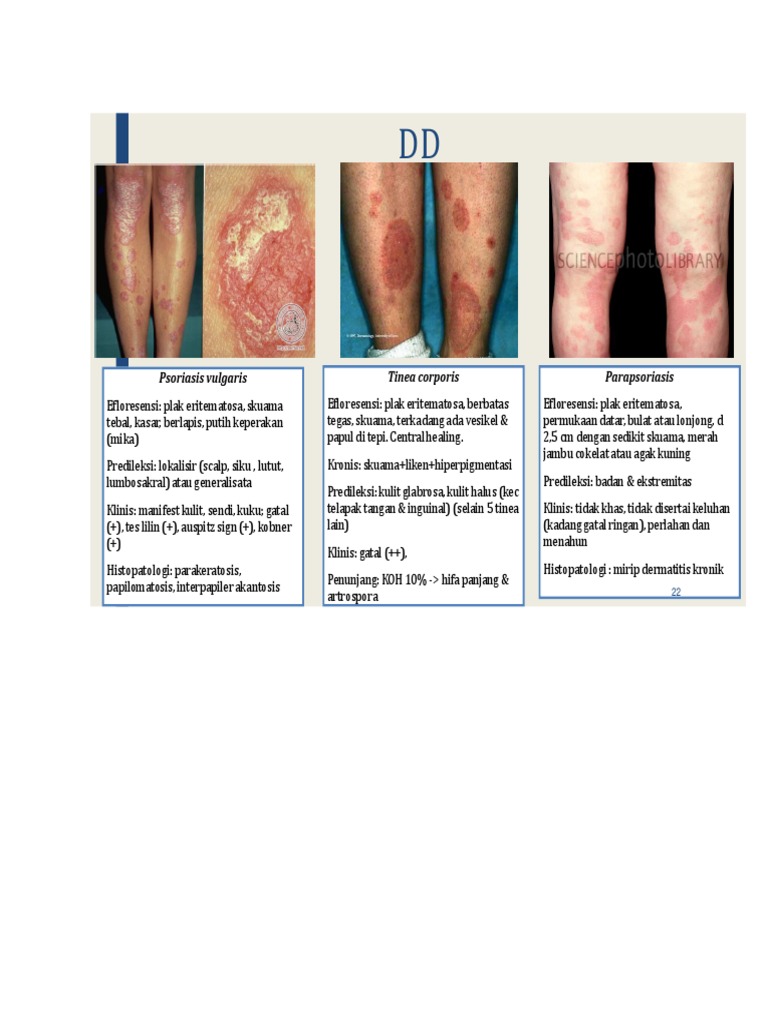Xotin bilan jinsiy aloqa, yaqin atrofdagi xotin