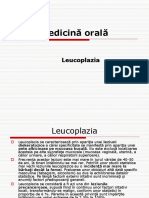 Leucoplazia