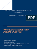 36165123-Procedimientos-Quirurgicos-del-Pancreas.pdf