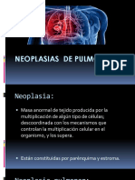 Neoplasias de Pulmón