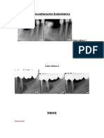 desobturacion endodontica