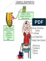 Glumerulonephritis PDF