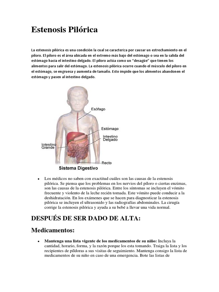 Estenosis Pilórica | PDF | Medicamentos con receta | Aspirina
