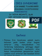 Plateau Iris Syndrome