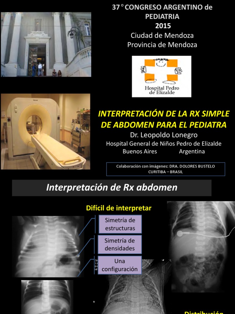 Lo Negro de Los RX | PDF | Abdomen | Estómago