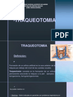 Traqueotomia