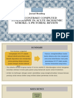 CT Scan Stroke Iskemik Akut