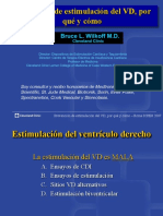 Prevención de estimulación del VD, por  qué y cómo