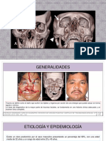 Trauma Maxilofacial - Final 09.09.18