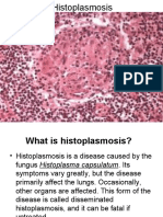 Histoplasmosis and Cryptococcosis