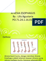 Atresia Esophagus