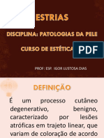 Aula 8 - Estrias