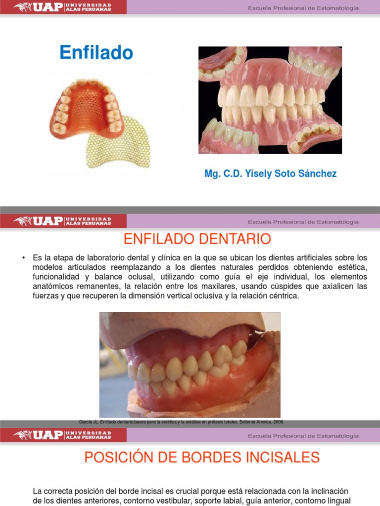 Semana 13 Enfilado PDF | PDF | Boca | Ramas de Odontología