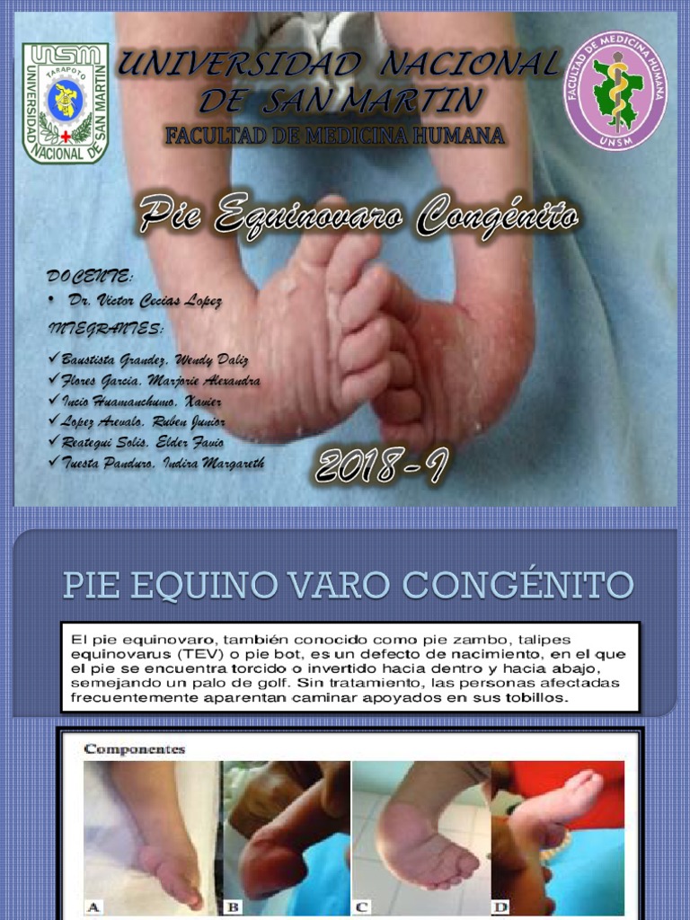 10.PIEEQUINOVAROCONGÉNITO Pie Sistema musculoesquelético