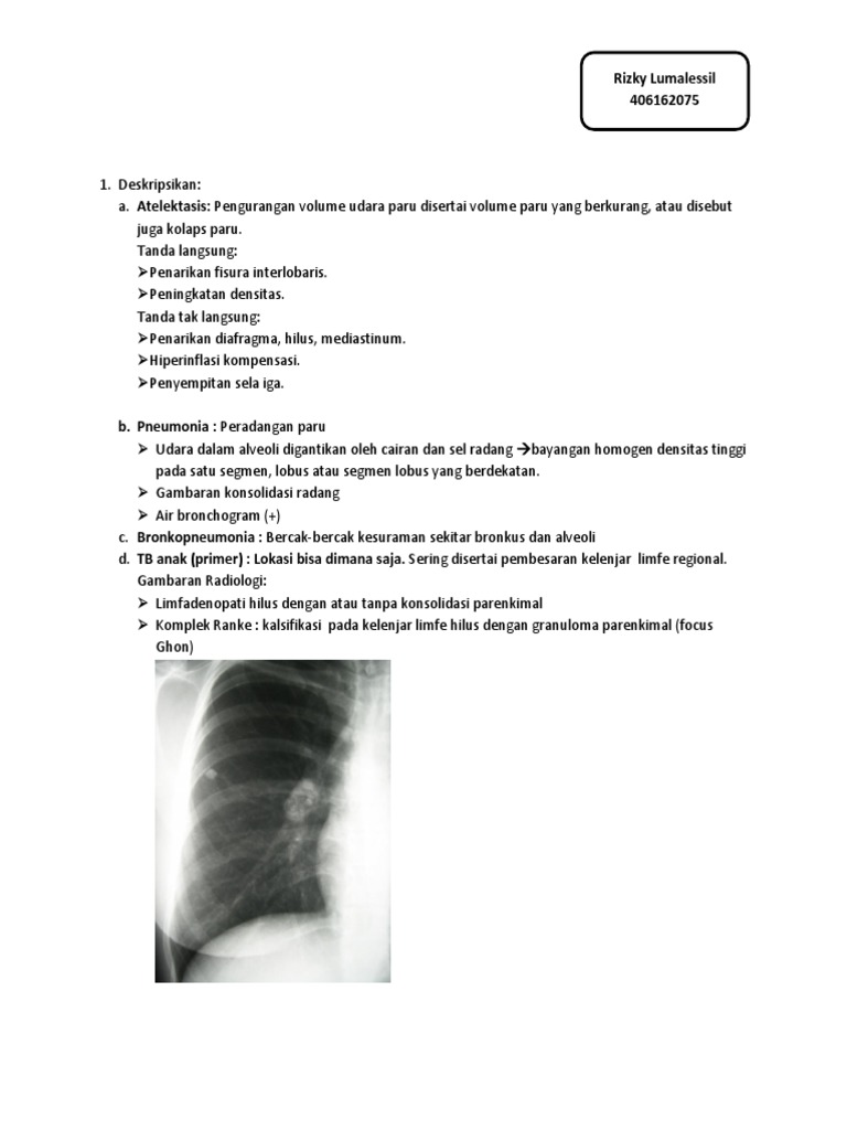 Gambaran Radiologi Penyakit Paru | PDF | Kajian Bahasa Asing