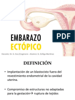 Embarazo Ectópico - PRESENTACION