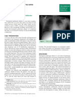 Seizure With Acute Pulmonary Infiltrates: Clinical Communication To The Editor