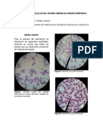 Observacion de Celulas Del Sistema Inmune en Sangre Periferica