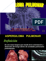 Aspergiloma Pulmonar-1