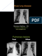 Diffuse Lung Disease PDF