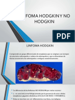 Linfoma Hodgkin y No Hodgkin