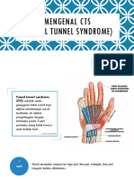 Mengenal Cts (Carpal Tunnel Syndrome)