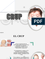 Crup 2
