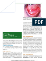 Occular Allergies - Nelson PDF