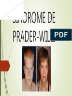 SINDROME DE PRADER-WILLI.ppt