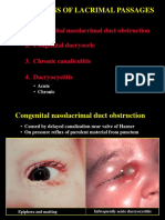 Infections of Lacrimal Passages