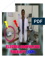 Electroconvulsivetherapyect 160819110304 PDF