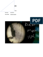 Congestive Heart Failure - New-1