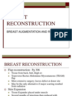 Реферат: Breast Reconstruction Essay Research Paper Postmastectomy breast