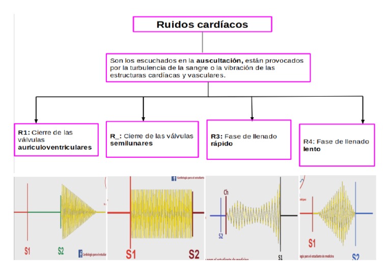 Mapa Conceptual Ruidos Cardíacos | PDF
