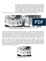 Processus Zygomatic