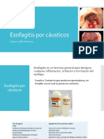 Esofagitis Por Cáusticos