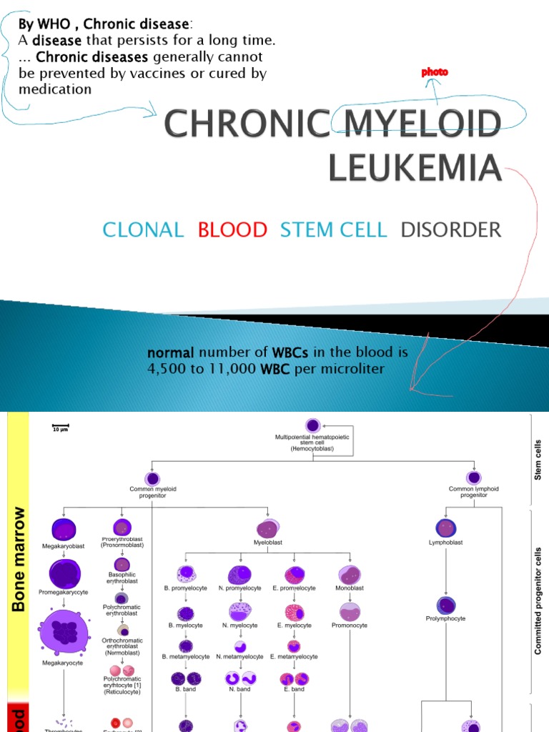 Chronic Myeloid Leukemia | PDF | Leukemia | Fluorescence In Situ ...