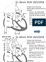 Mulin Right Heart Catheterization