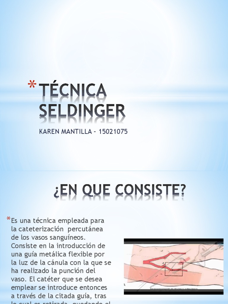 Técnica Seldinger | PDF