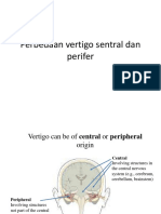 Perbedaan Vertigo Sentral Dan Perifer