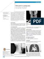 Case of Chest Pain in A Young Man: Ankit Gupta, Atul Vijay Palkar, Priya Narwal