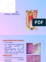 Infecciones Bucales PERIAPICALES