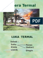 Luka Termal