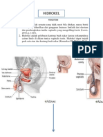 Hidrocele Pathway