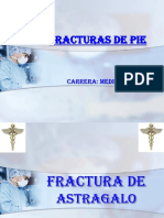 12.-FRACTURAS DEL PIE.ppt