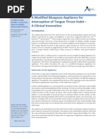 A Modified Bluegrass Appliance For Interception of Tongue Thrust Habit - A Clinical Innovati