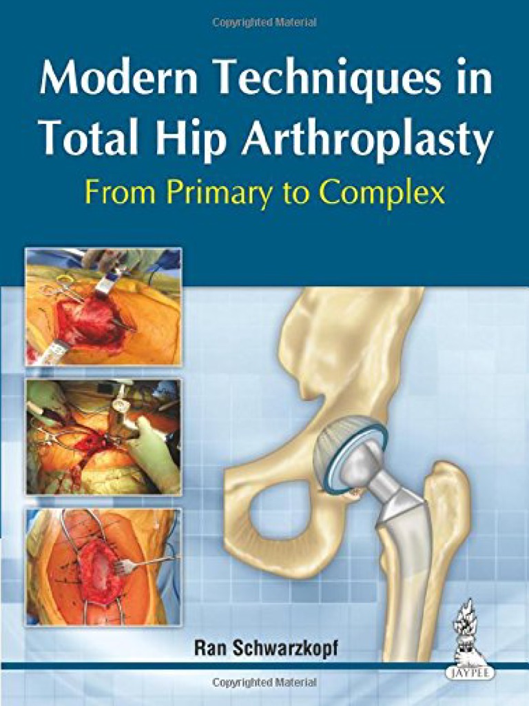 Modern Techniques in Total Hip Arthroplasty From Primary To Complex