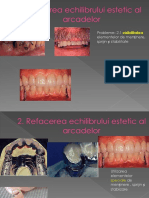 Refacerea Echilibrului Estetic Al Arcadelor